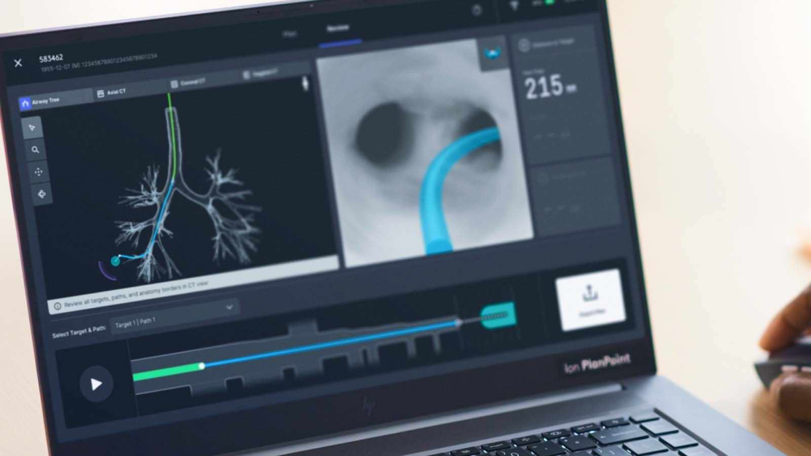 ion planpoint software